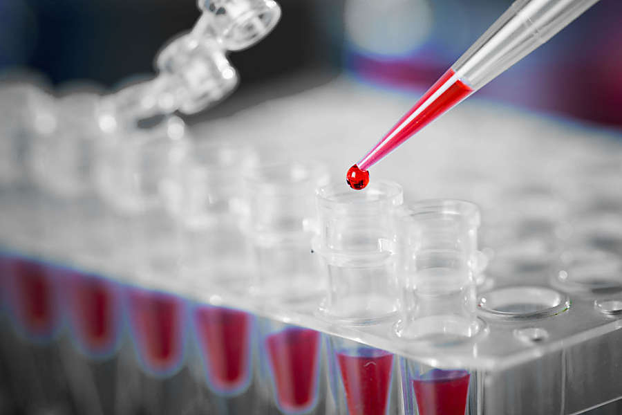 India must change its testing strategy